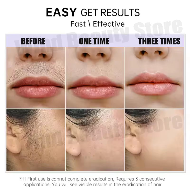 SmoothSilk Painless Hair Removal Cream – Fast, Gentle & Whitening Formula for Lip, Underarm & Sensitive Skin